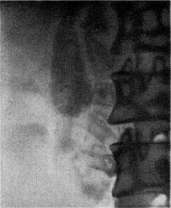 Gallbladder: figure 37 from the 1928–1936 encyclopedia article