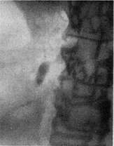 Gallbladder: figure 41 from the 1928–1936 encyclopedia article
