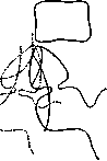 Gallbladder: figure 43 from the 1928–1936 encyclopedia article