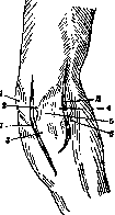 Elbow Joint: figure 17 from the 1928–1936 encyclopedia article