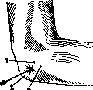 Elbow Joint: figure 16 from the 1928–1936 encyclopedia article