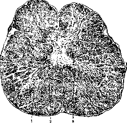 SPINELLI: figure 5 from the 1928–1936 encyclopedia article