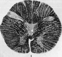SPINELLI: figure 26 from the 1928–1936 encyclopedia article