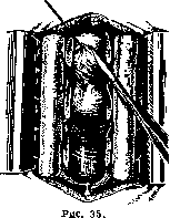 SPINELLI: figure 39 from the 1928–1936 encyclopedia article