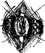 SPINELLI: figure 42 from the 1928–1936 encyclopedia article