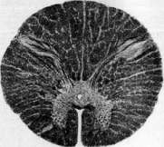 SPINELLI: figure 27 from the 1928–1936 encyclopedia article