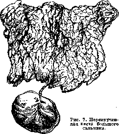 Omentum: figure 7 from the 1928–1936 encyclopedia article