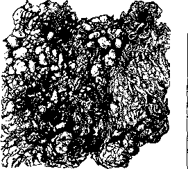 Omentum: figure 6 from the 1928–1936 encyclopedia article