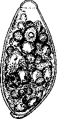 Gastroduodenostomy: figure 1 from the 1928–1936 encyclopedia article