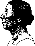 Graves' Disease: figure 2 from the 1928–1936 encyclopedia article