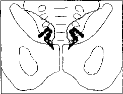 Vesiculography: figure 1 from the 1928–1936 encyclopedia article