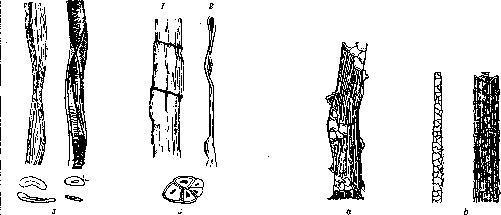 Sphincter of Oddi: figure 2 from the 1928–1936 encyclopedia article