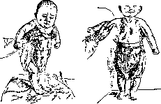 Sphincter of Oddi: figure 11 from the 1928–1936 encyclopedia article