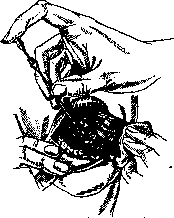 Radiotherapy: figure 1 from the 1928–1936 encyclopedia article
