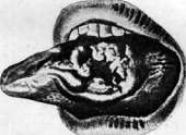 Radiotherapy: figure 6 from the 1928–1936 encyclopedia article