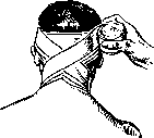 Desmurgy: figure 6 from the 1928–1936 encyclopedia article