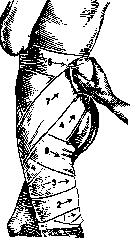 Desmurgy: figure 7 from the 1928–1936 encyclopedia article
