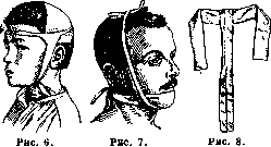 Desmurgy: figure 5 from the 1928–1936 encyclopedia article