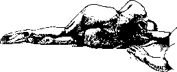 Lumbar Puncture: figure 3 from the 1928–1936 encyclopedia article