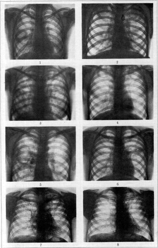 Cavities: figure 1 from the 1928–1936 encyclopedia article