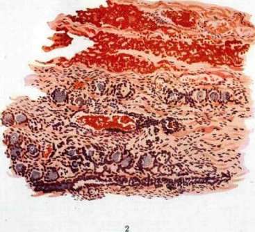 Hanko and Nerve Ganglia: figure 3 from the 1928–1936 encyclopedia article