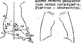 Heart Defects: figure 2 from the 1928–1936 encyclopedia article