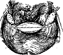 Salpingotomy: figure 4 from the 1928–1936 encyclopedia article