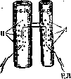 Zkovskaya Fistula: figure 2 from the 1928–1936 encyclopedia article