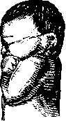 Breech Presentation: figure 13 from the 1928–1936 encyclopedia article