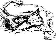 Breech Presentation: figure 19 from the 1928–1936 encyclopedia article
