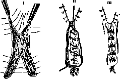 Breech Presentation: figure 60 from the 1928–1936 encyclopedia article