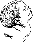 Childbirth: figure 19 from the 1928–1936 encyclopedia article