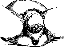 Childbirth: figure 22 from the 1928–1936 encyclopedia article