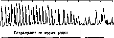 Breech Presentation: figure 31 from the 1928–1936 encyclopedia article