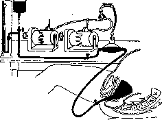 Breech Presentation: figure 26 from the 1928–1936 encyclopedia article