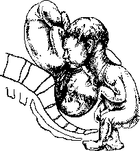 Breech Presentation: figure 46 from the 1928–1936 encyclopedia article