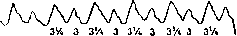 Cardiac Arrhythmias: figure 13 from the 1928–1936 encyclopedia article