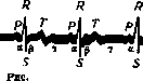 Cardiac Arrhythmias: figure 1 from the 1928–1936 encyclopedia article