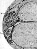 Labyrinthitis: figure 3 from the 1928–1936 encyclopedia article