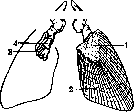 Condurango and Limbs: figure 2 from the 1928–1936 encyclopedia article
