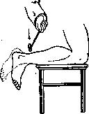 Achillini: figure 1 from the 1928–1936 encyclopedia article