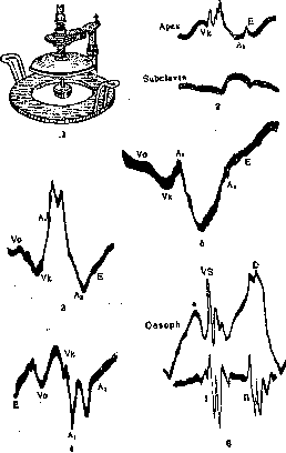 Cardiography: figure 1 from the 1928–1936 encyclopedia article