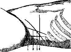 Lumbar Region: figure 3 from the 1928–1936 encyclopedia article