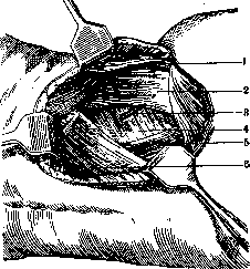 Lumbar Region: figure 5 from the 1928–1936 encyclopedia article