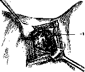 Lumbar Region: figure 7 from the 1928–1936 encyclopedia article