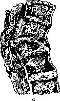 Vertebral Column: figure 38 from the 1928–1936 encyclopedia article