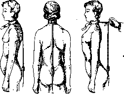 Vertebral Column: figure 25 from the 1928–1936 encyclopedia article