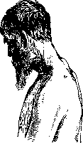 Vertebral Column: figure 35 from the 1928–1936 encyclopedia article