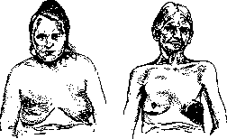 Mammary Gland: figure 15 from the 1928–1936 encyclopedia article