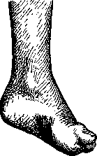 Ataxia: figure 1 from the 1928–1936 encyclopedia article